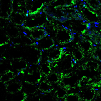 TFRC Antibody