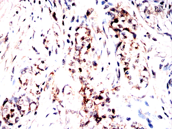 TFRC Antibody