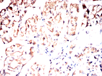 TFRC Antibody