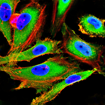 TFRC Antibody