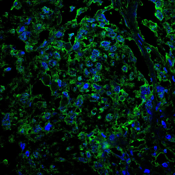 ADAR Antibody