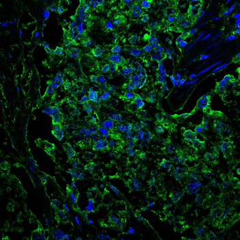 ADAR Antibody