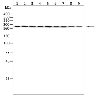 GRIN2A Antibody