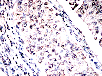 TBP Antibody