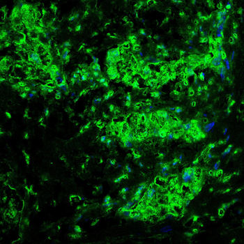 TBP Antibody