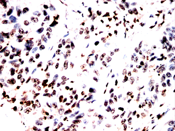 TBP Antibody