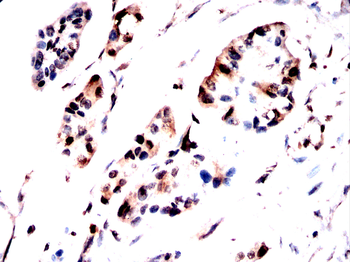 TBP Antibody