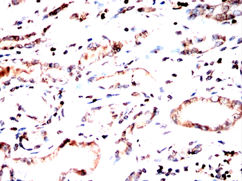 TBP Antibody