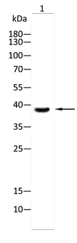 TBP Antibody