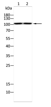 GABBR1 Antibody