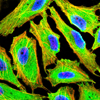 GABBR1 Antibody