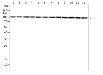 ACTN1 Antibody