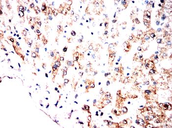 KLC1 Antibody