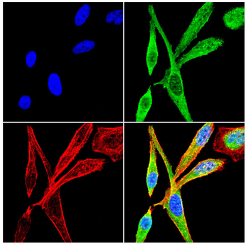 PHACTR1 Antibody