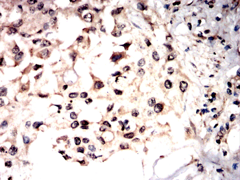 PHACTR1 Antibody