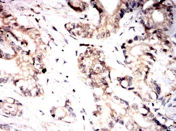 PHACTR1 Antibody