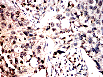 PHACTR1 Antibody