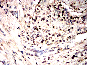 PHACTR1 Antibody