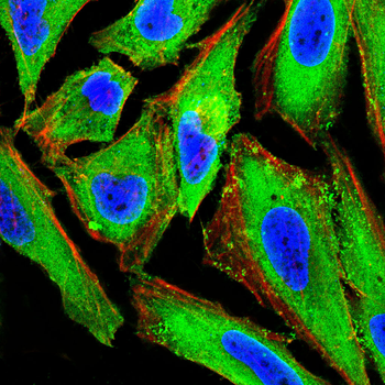 PHACTR1 Antibody