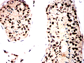 EEF1D Antibody