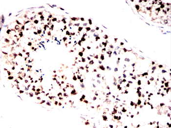 EEF1D Antibody