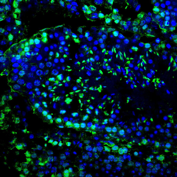 EEF1D Antibody