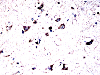 GRIN2B Antibody