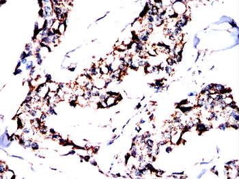 GRIN2B Antibody
