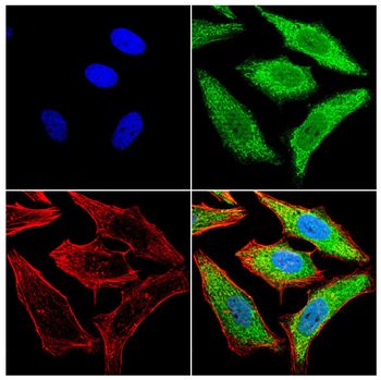 PRAME Antibody