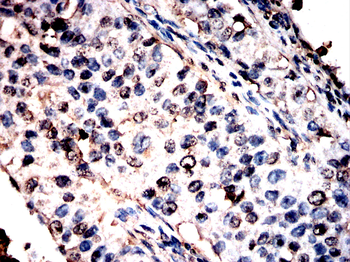 PRAME Antibody