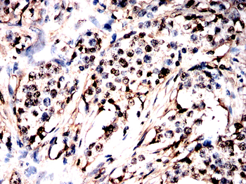 PRAME Antibody