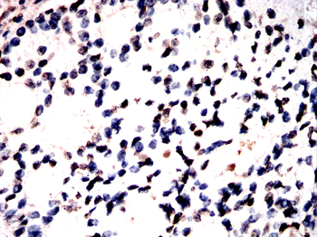 PRAME Antibody