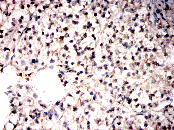 PRAME Antibody