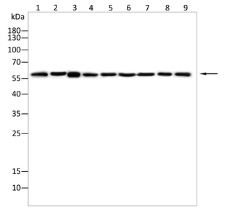 PRAME Antibody