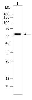 PRAME Antibody