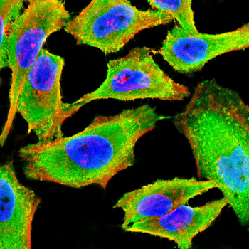 PRAME Antibody