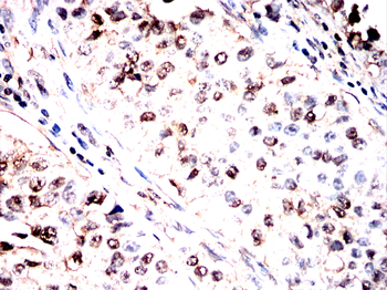 PRAME Antibody