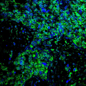 PRAME Antibody