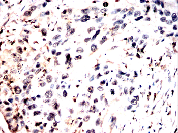 PRAME Antibody