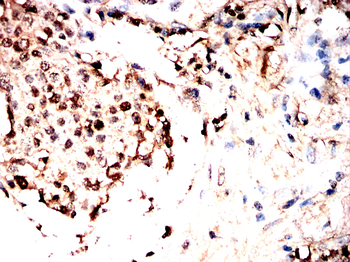 PRAME Antibody
