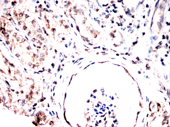 PRAME Antibody