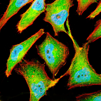 NUTM1 Antibody