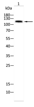 NUTM1 Antibody