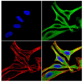 ENPP1 Antibody