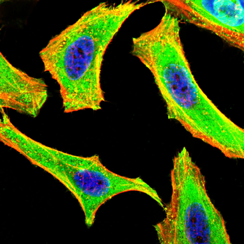 CXCL9 Antibody