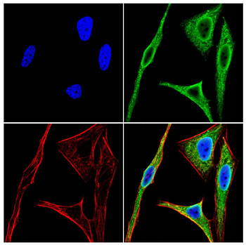 PAK1 Antibody