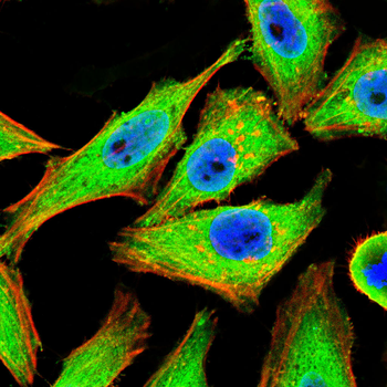 PAK1 Antibody