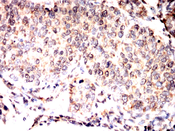 PAK1 Antibody