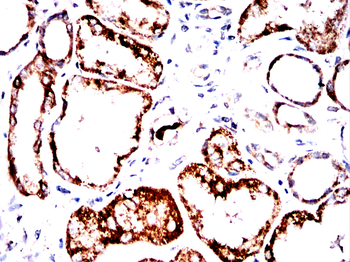 ACAT1 Antibody