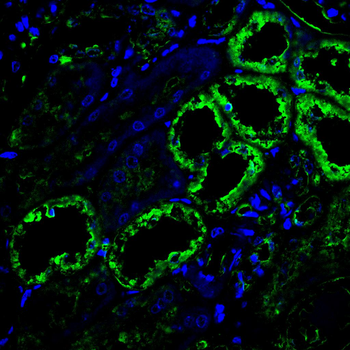 ACAT1 Antibody